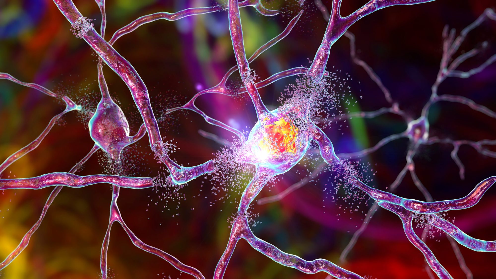 neurodegenerative