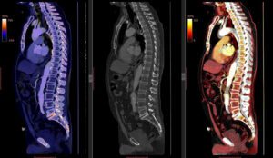 shutterstock 1361378546