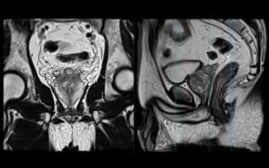 shutterstock 2461238315